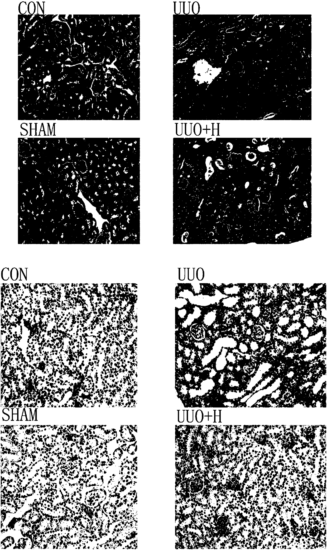 Purpose of hydrogen gas to preparation of renal fibrosis treatment preparation