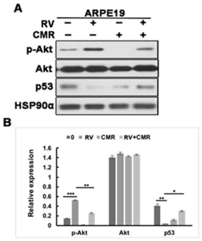 Application of chalcomoracin in the preparation of drugs for the treatment of proliferative vitreoretinopathy