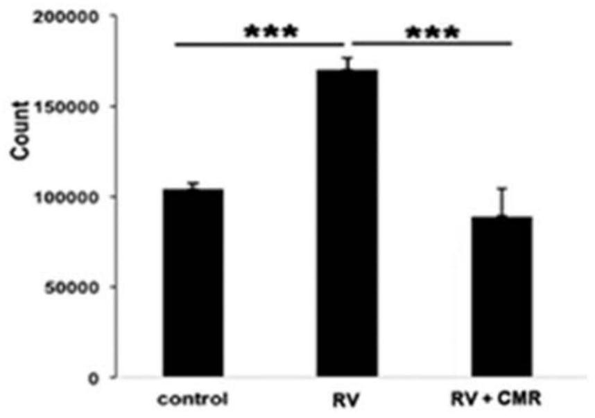 Application of chalcomoracin in the preparation of drugs for the treatment of proliferative vitreoretinopathy