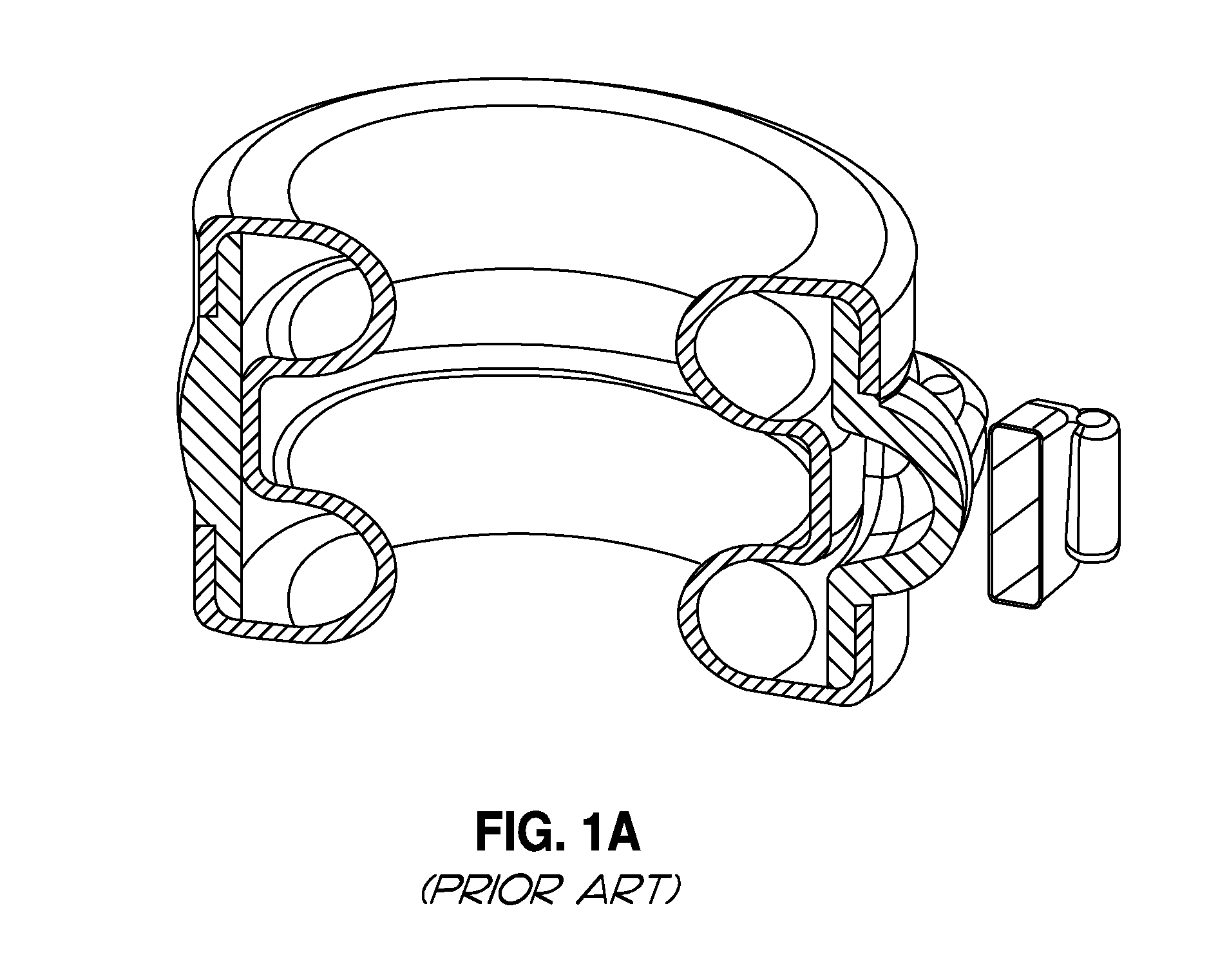 Gastric bands for reducing obstructions