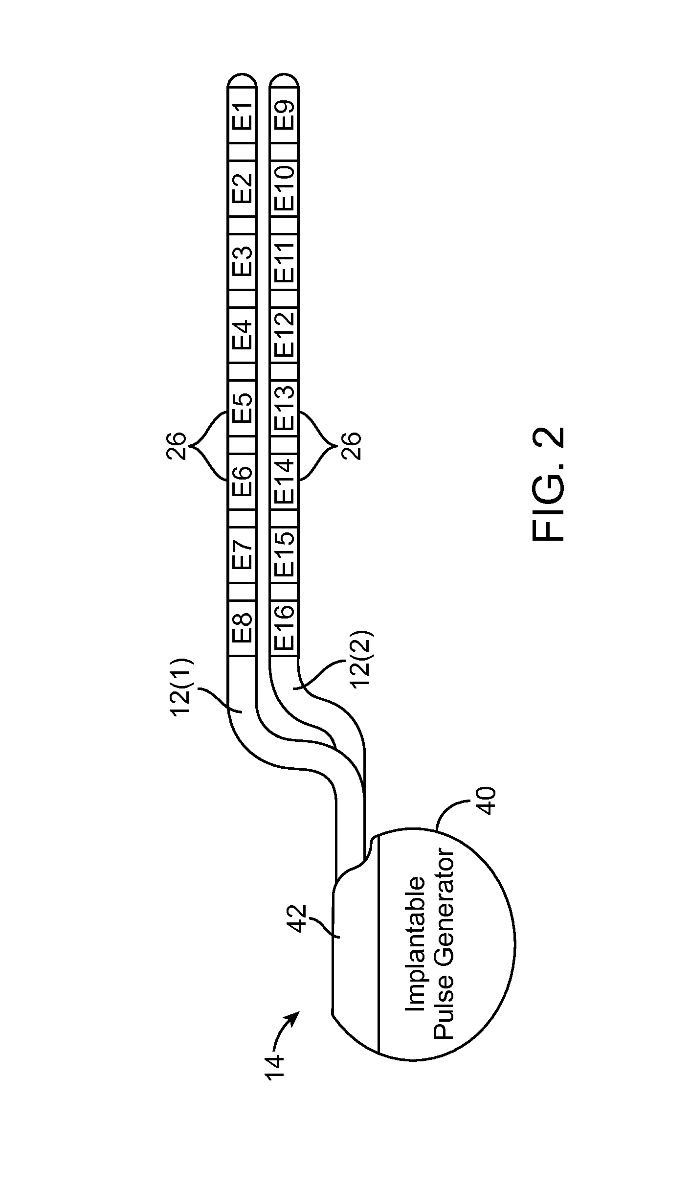 Use of compound action potentials to automatically adjust neurostimulation therapy in response to postural changes of patient