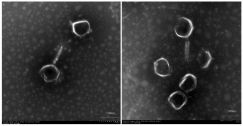 Enterococcus faecalis phage and separation, purification, enrichment and application thereof