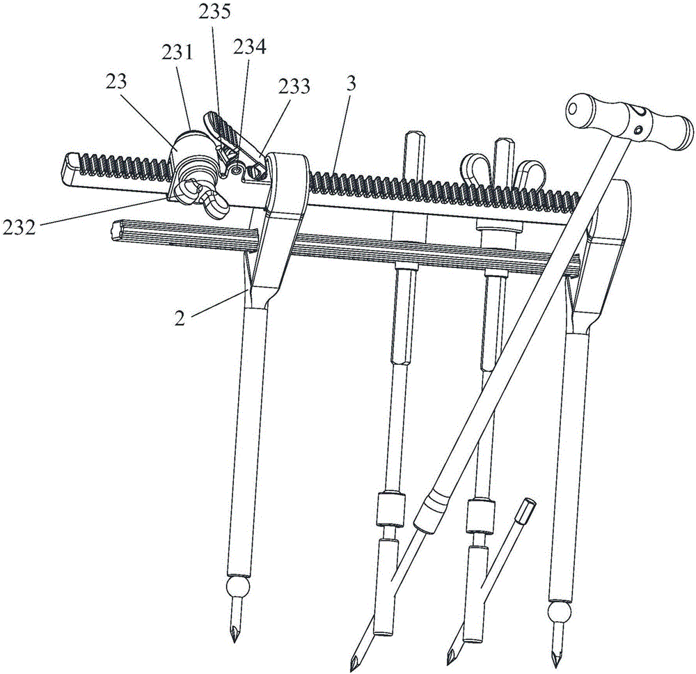 Anterior cervical controllable advancement apparatus