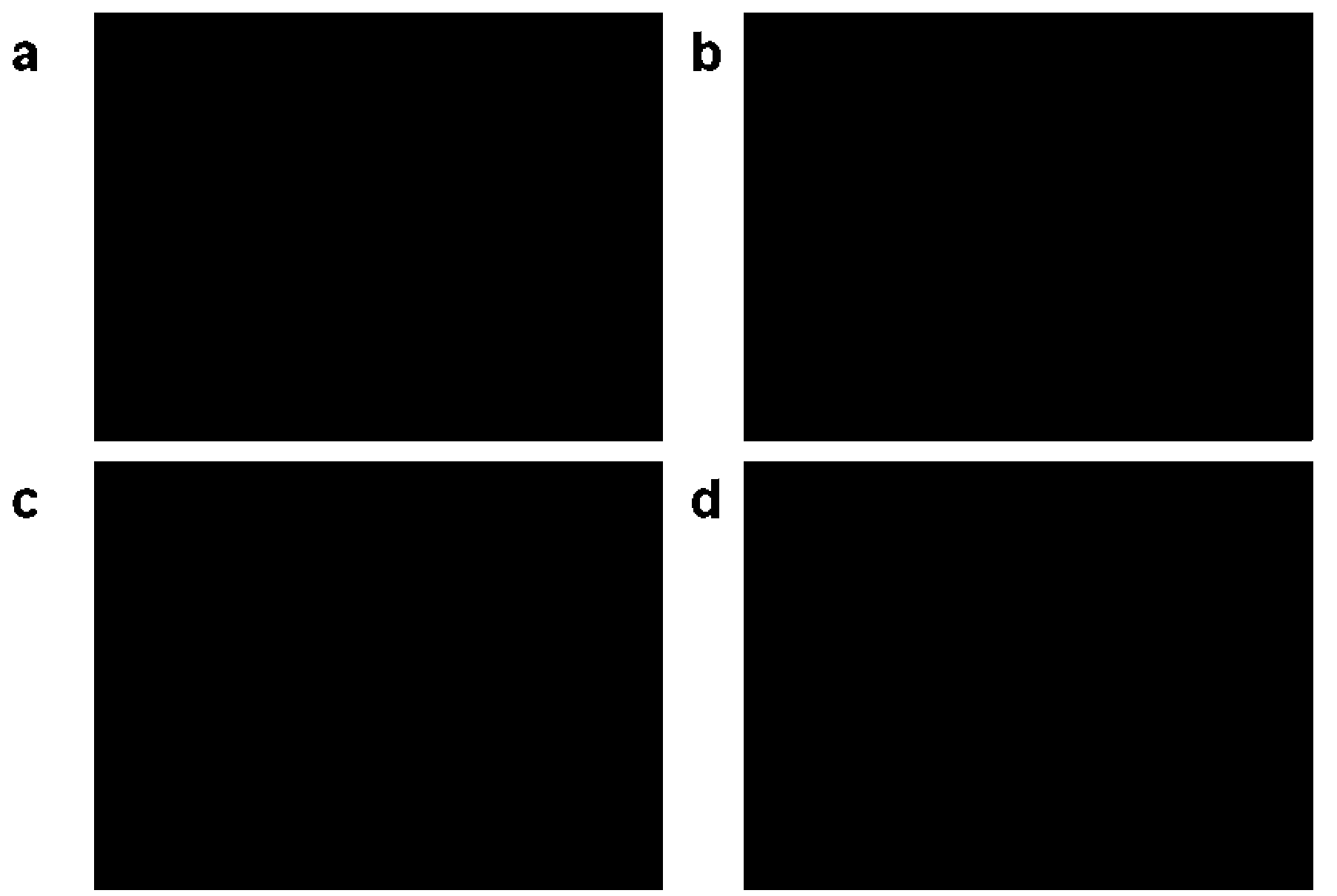 Hair-like hydrophilic polymer hybridization magnetic nanoparticle immobilized enzyme and preparation method thereof