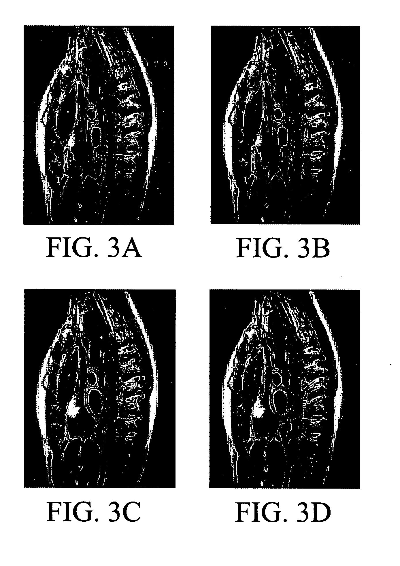 Method for generating fast magnetic resonance images