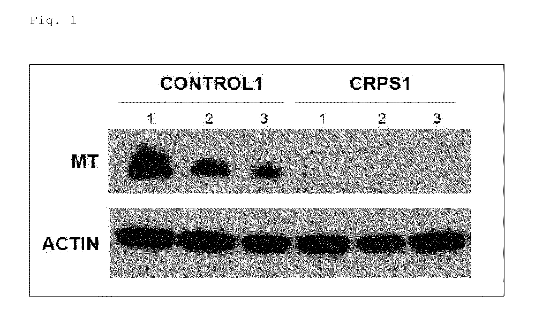 Composition for treating, improving, or preventing pain