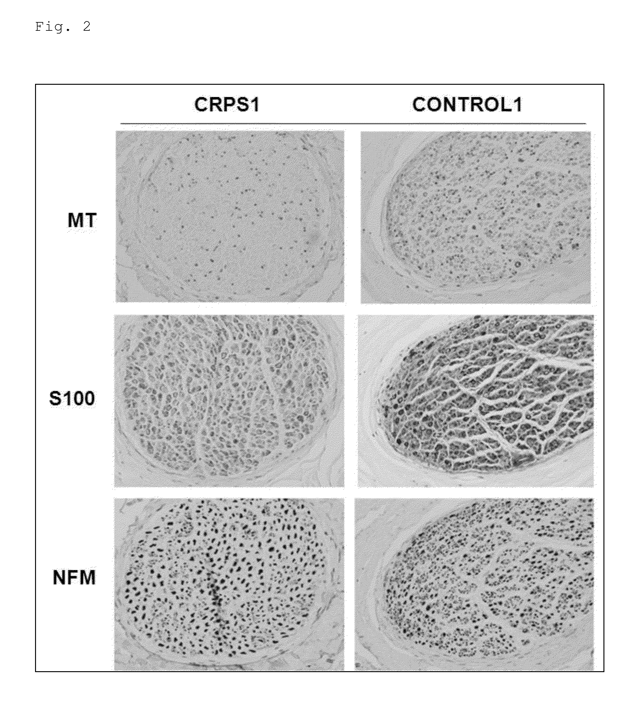 Composition for treating, improving, or preventing pain