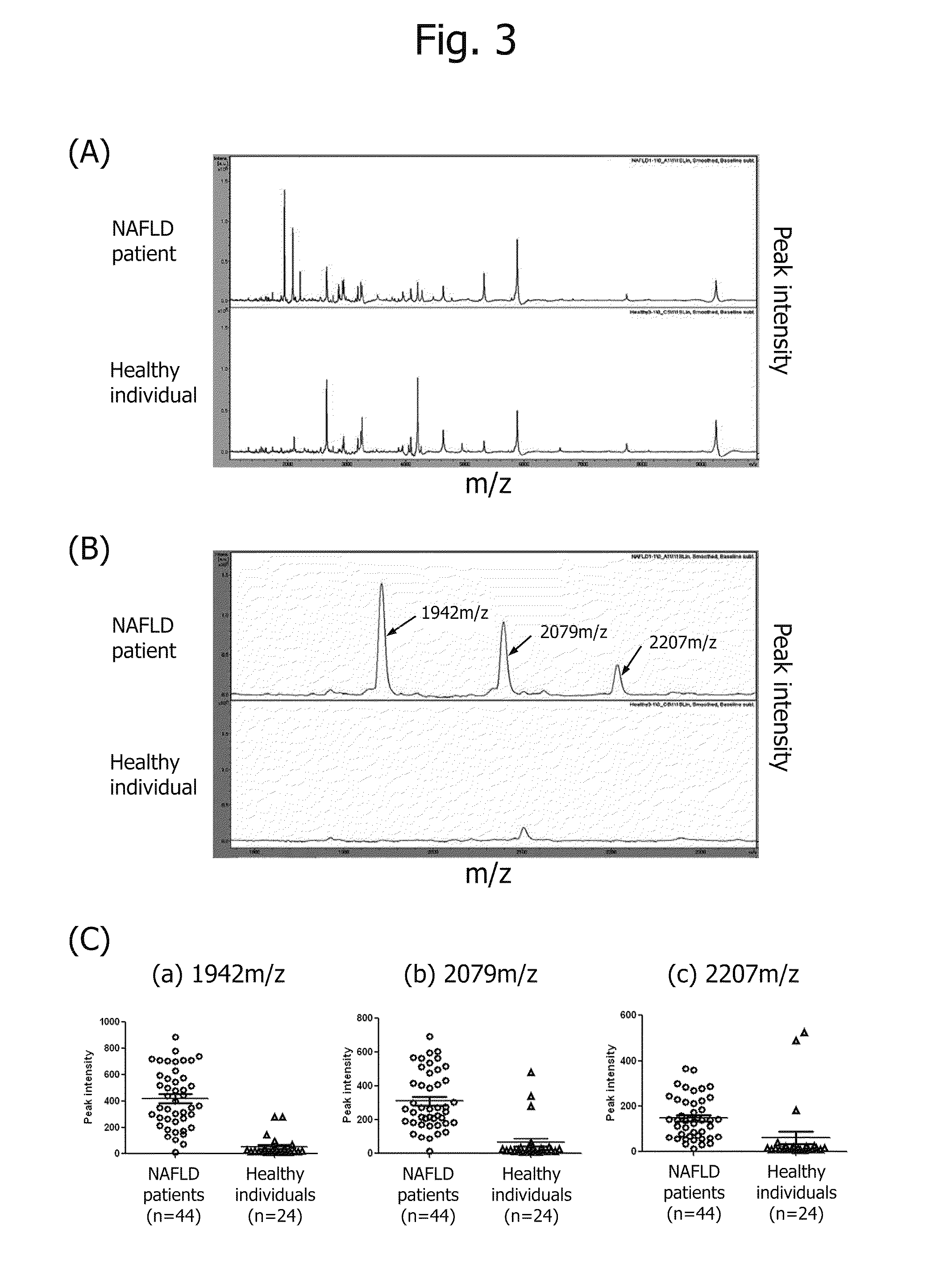 Biomarker for diagnosis of liver disease