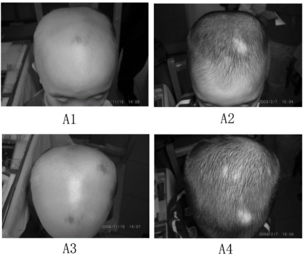 Plant anti-hair-loss hair nourishing and hair growing liquid and preparation method thereof