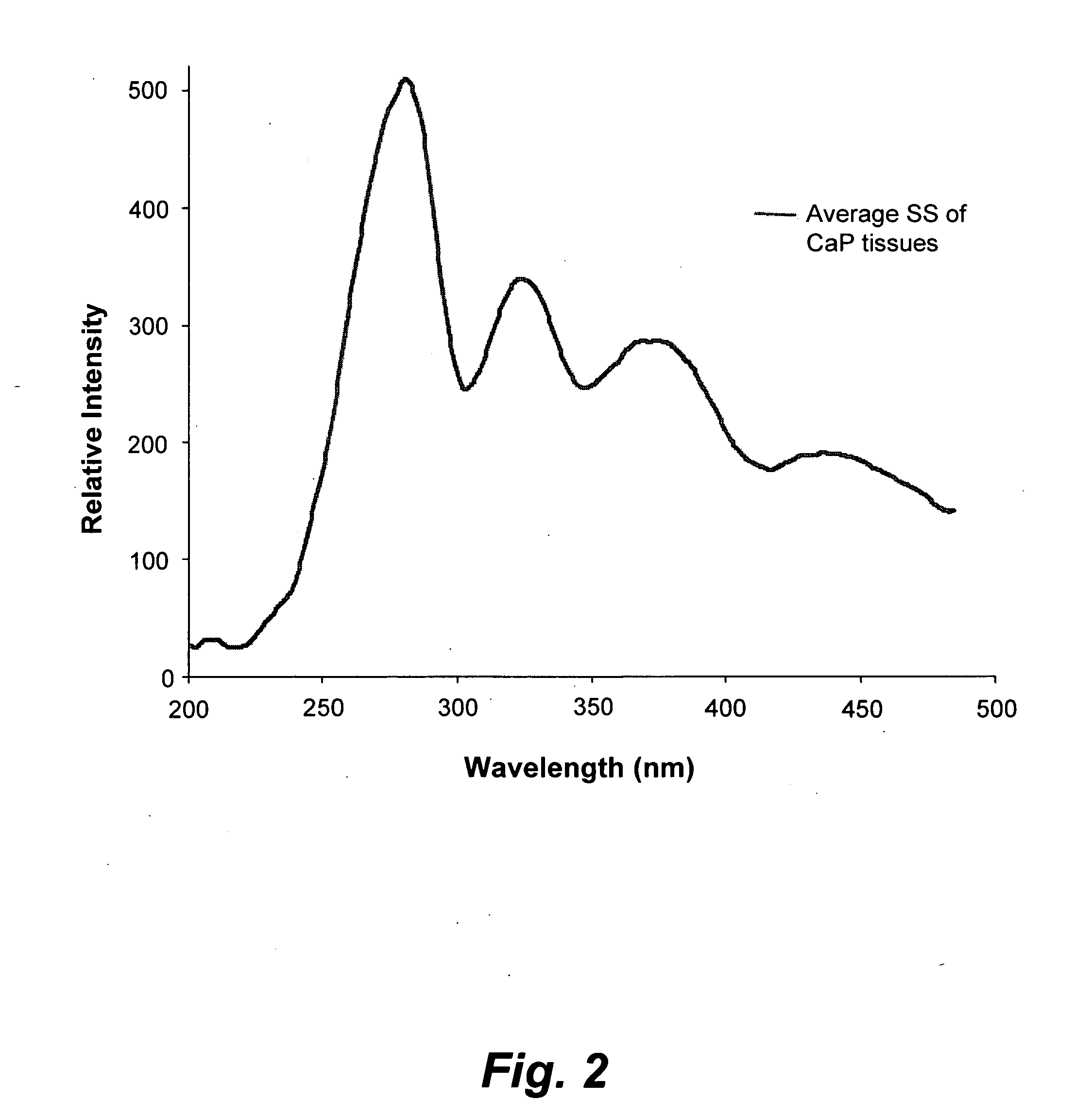 Method for discriminating between benign and malignant prostate tumors