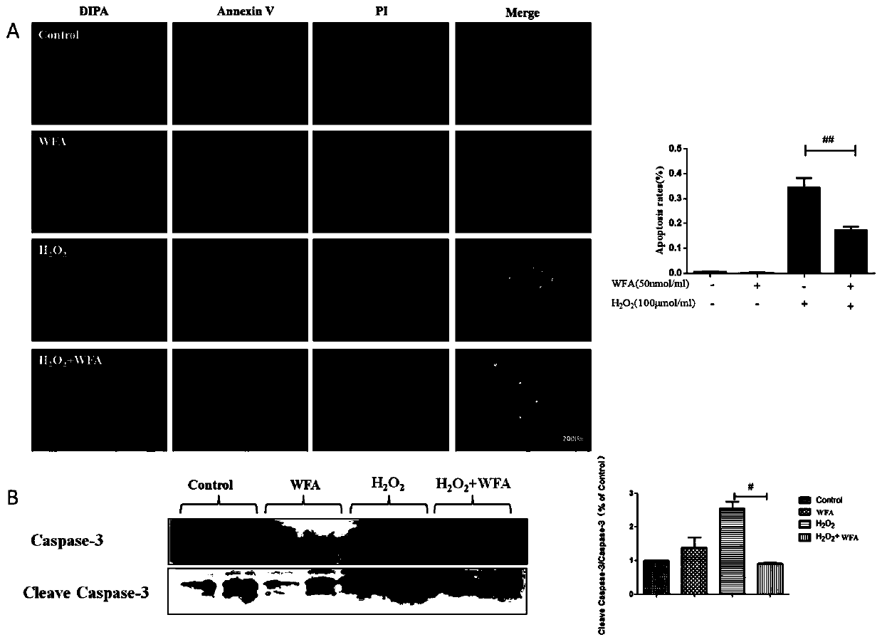 Application of Withaferin A in preparing drug for treating fundus ischemic disease