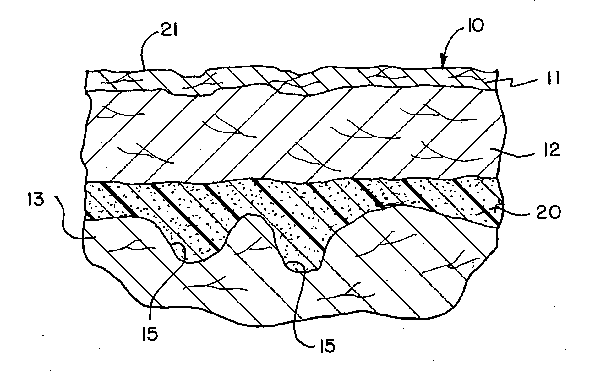 Soft tissue substitute and method of soft tissue reformation