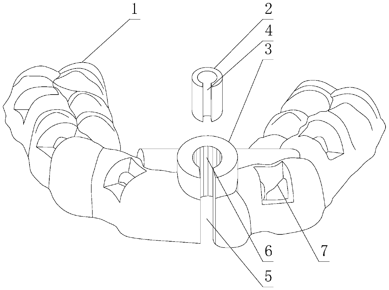 Dental pulp cavity approach guide plate for incisors and canines