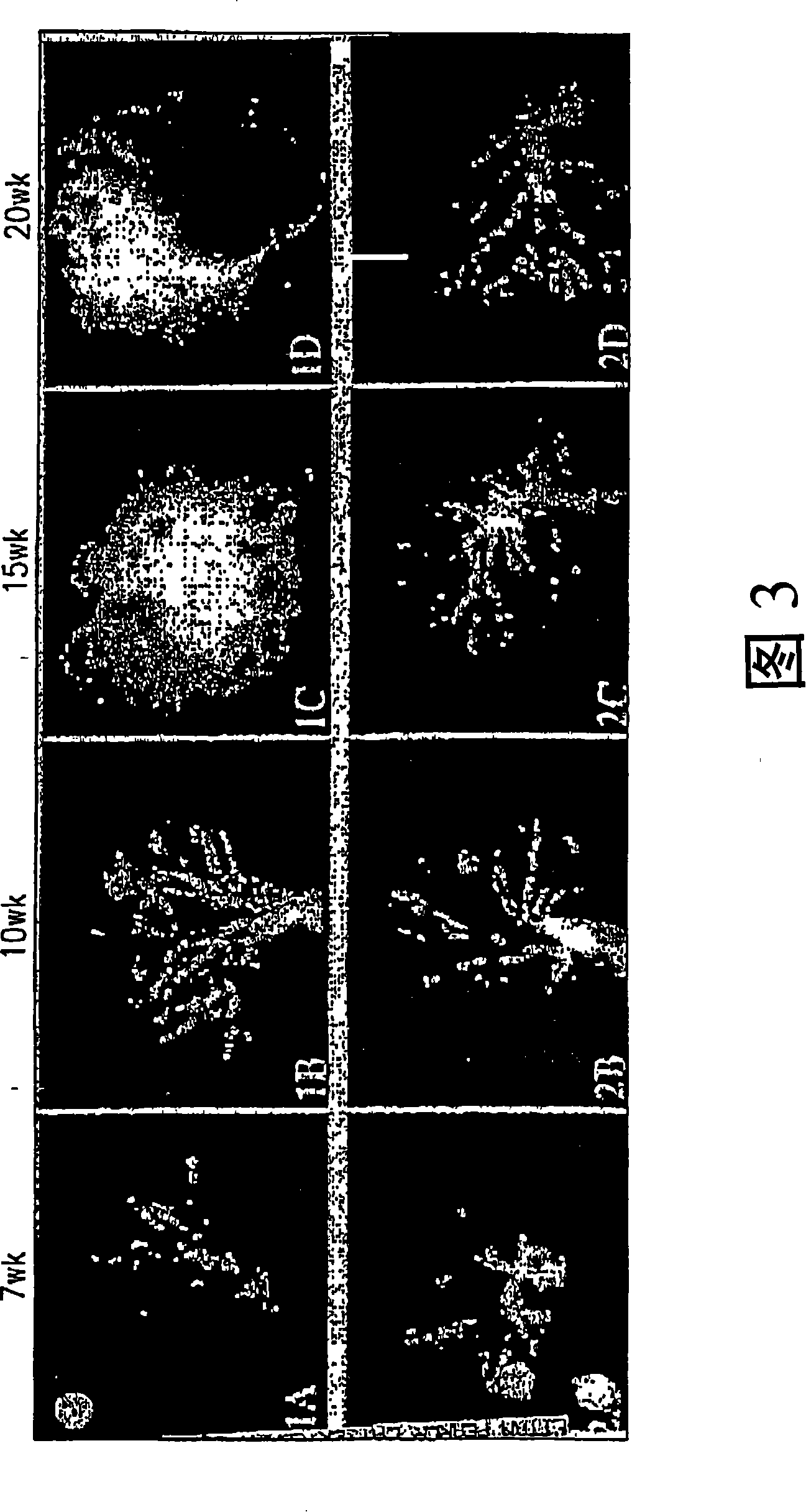 Method for chemoprevention of prostate cancer