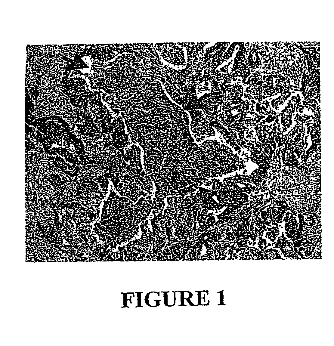 Combination bacteriolytic therapy for the treatment of tumors