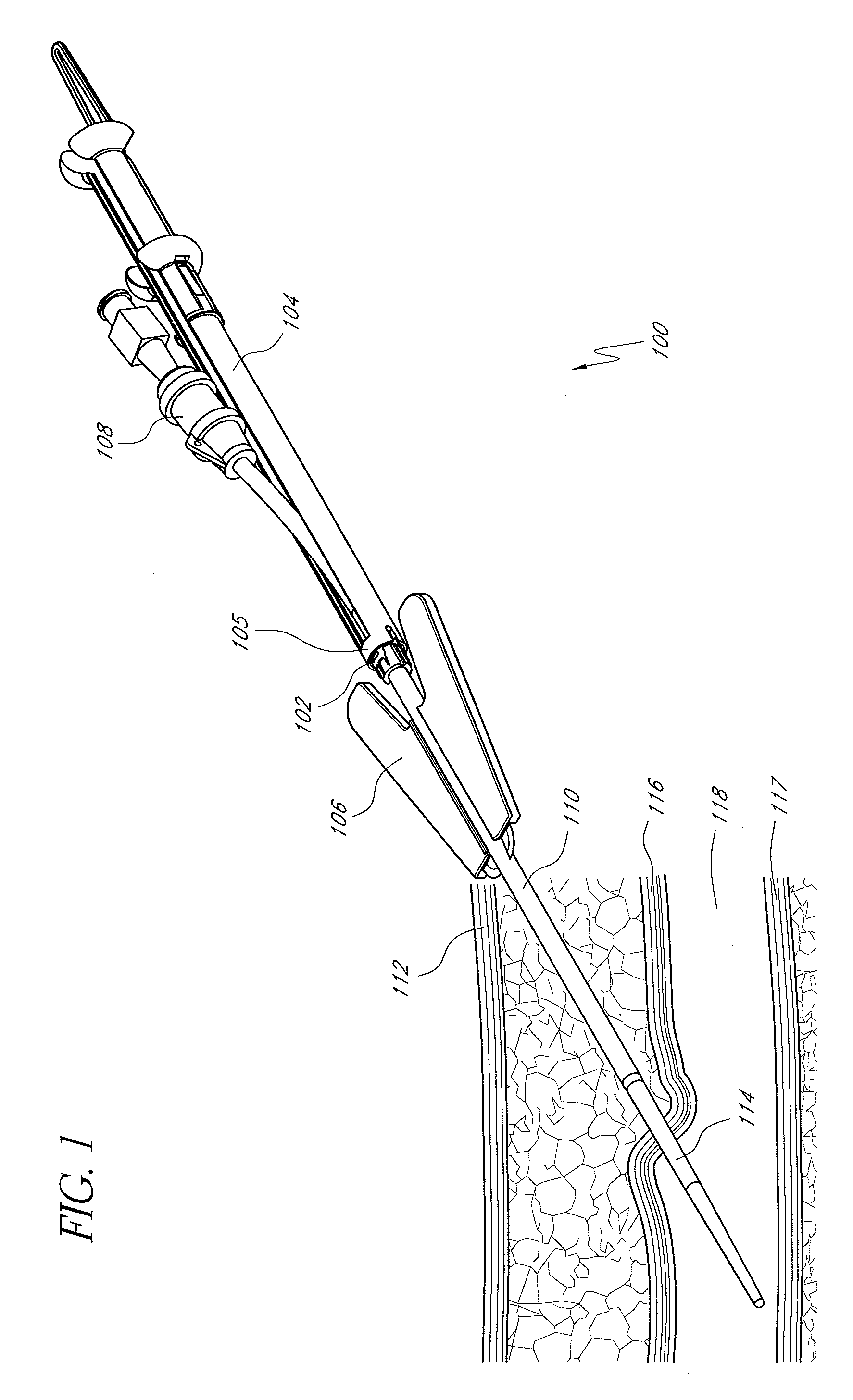 Vascular closure devices, systems, and methods of use