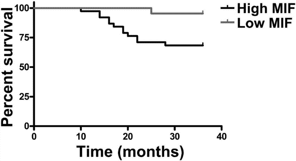 shRNA medicine capable of specifically inhibiting macrophage migration inhibition factor (MIF) and application thereof