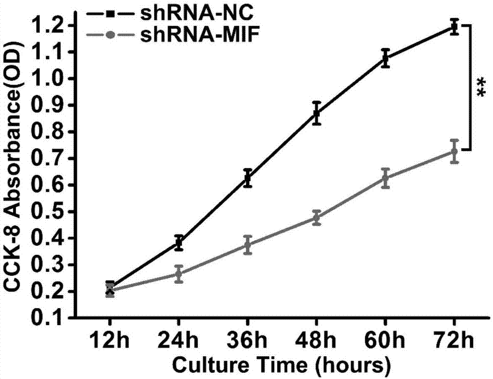 shRNA medicine capable of specifically inhibiting macrophage migration inhibition factor (MIF) and application thereof