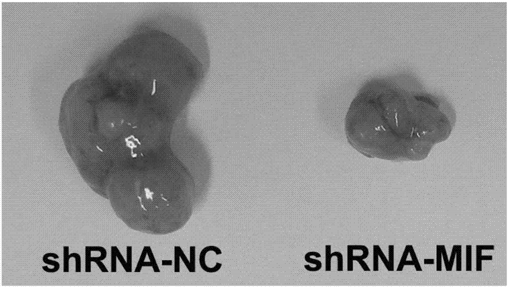 shRNA medicine capable of specifically inhibiting macrophage migration inhibition factor (MIF) and application thereof