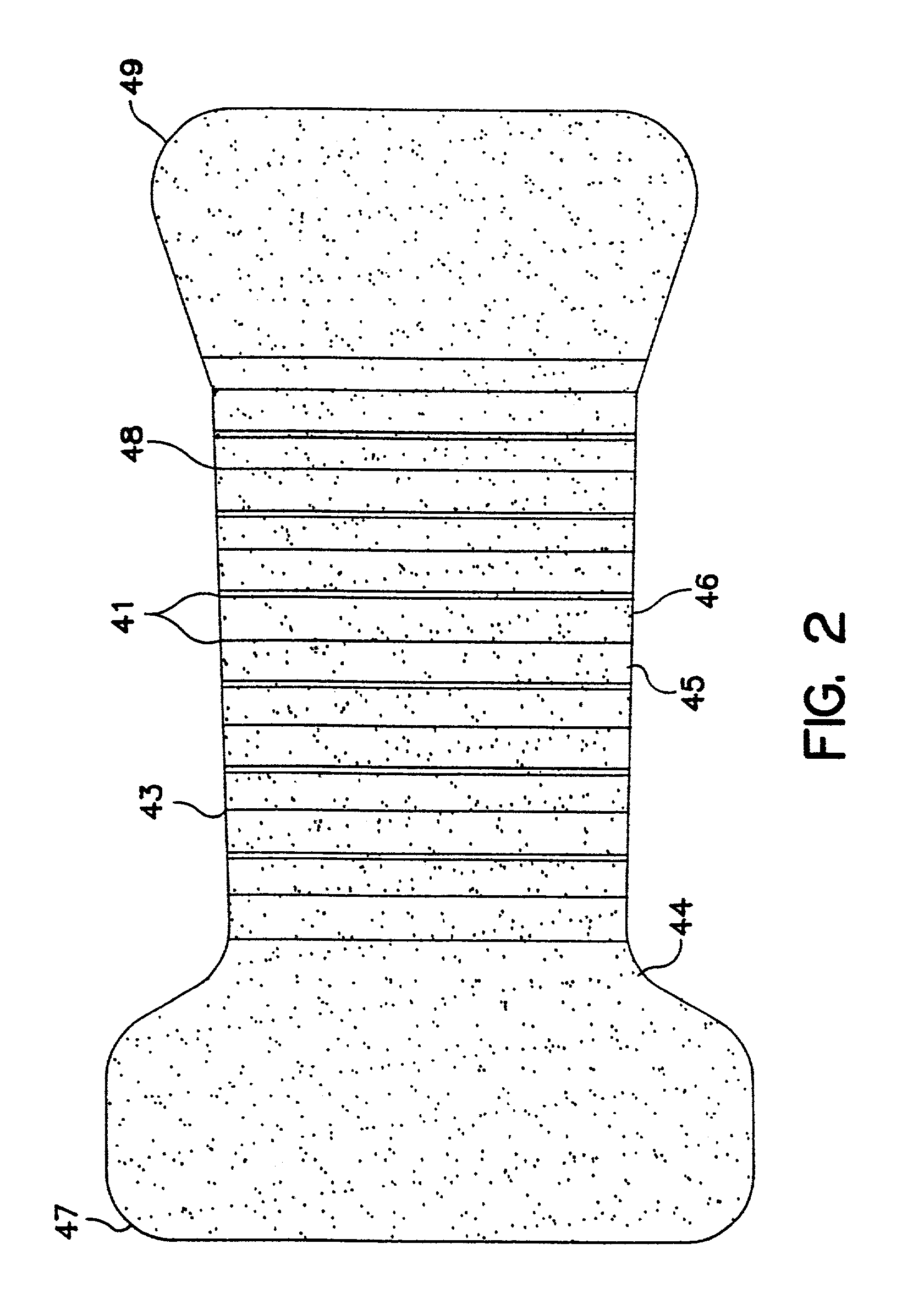 Incontinence garment having pleated extensible liquid retention layer