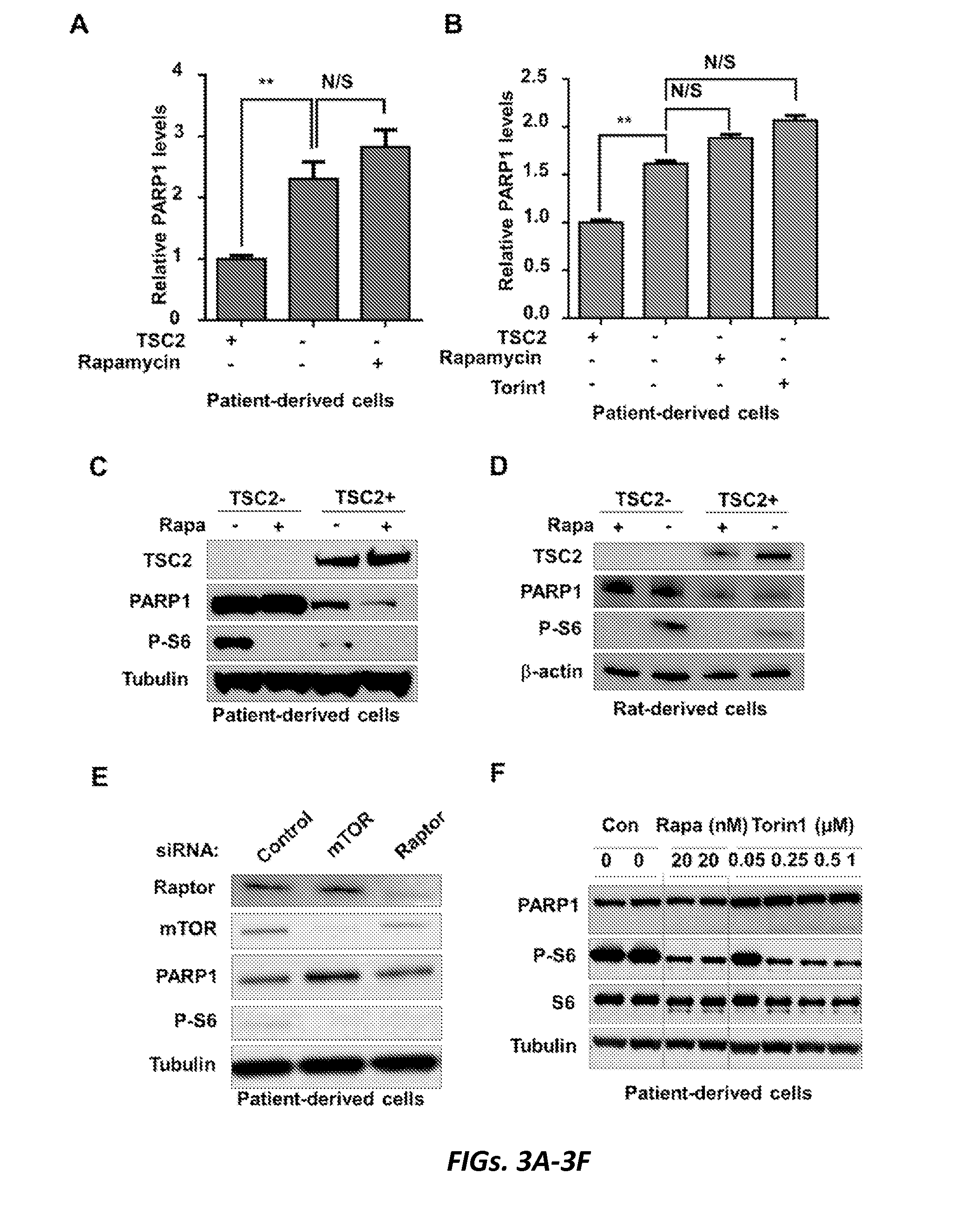 Targeting parp1 for treatment of tsc and cancers