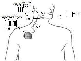 Snoring sleep apnea prevention system