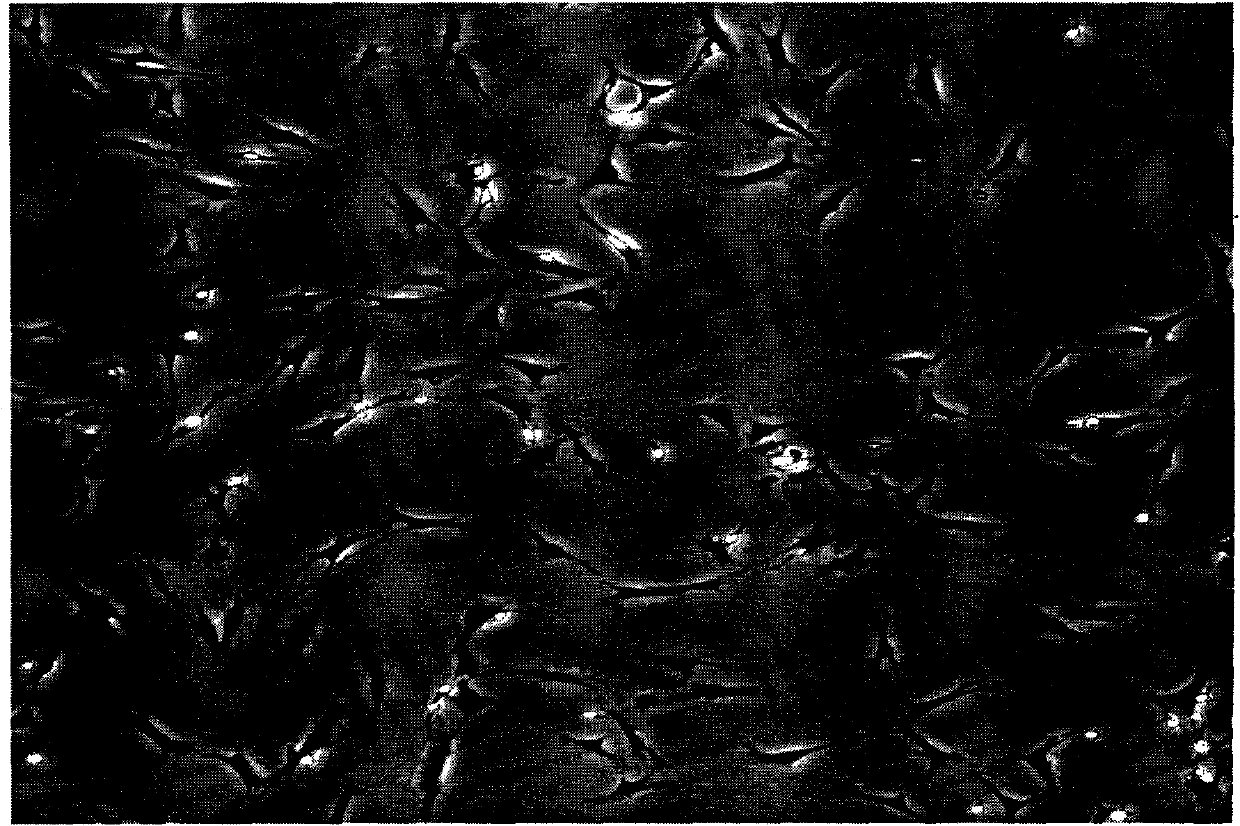 Method for separating and purifying schwann cells