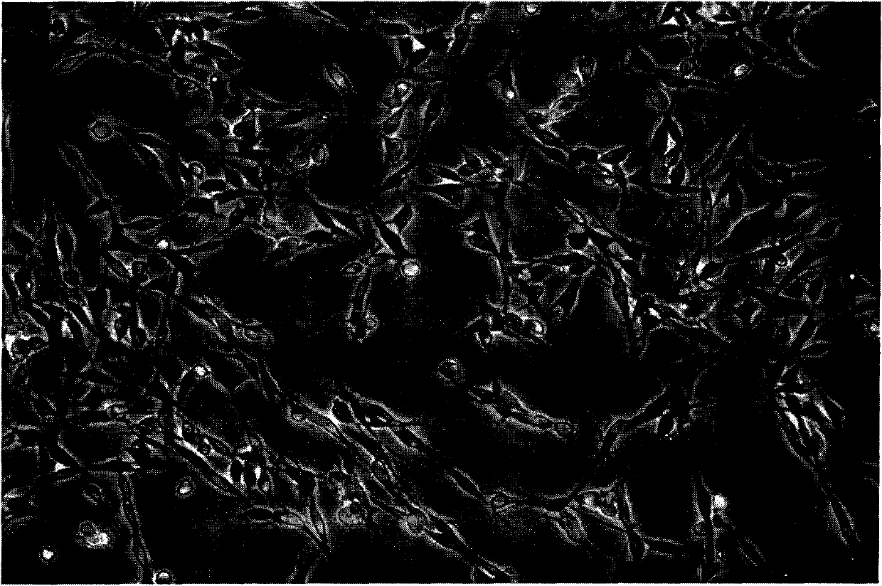 Method for separating and purifying schwann cells