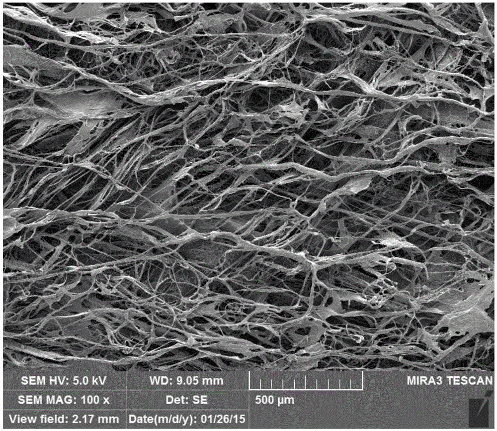 Acellular dermal matrix and preparing method of acellular dermal matrix