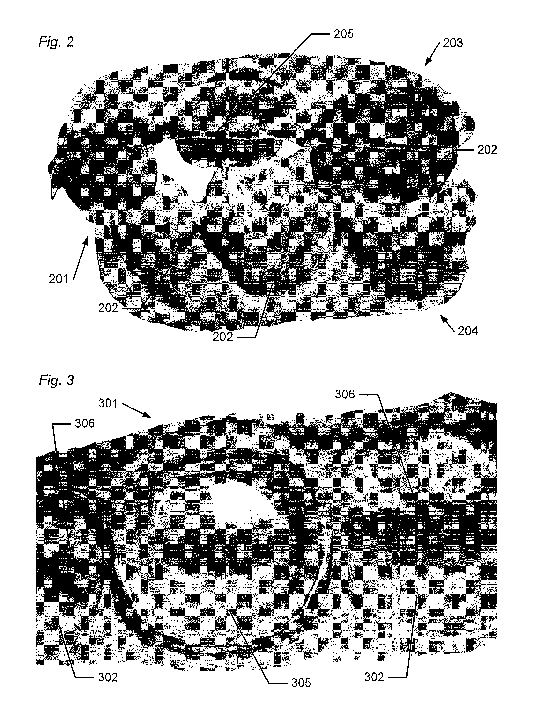 Support of removable components in a teeth model manufactured by means of CAM