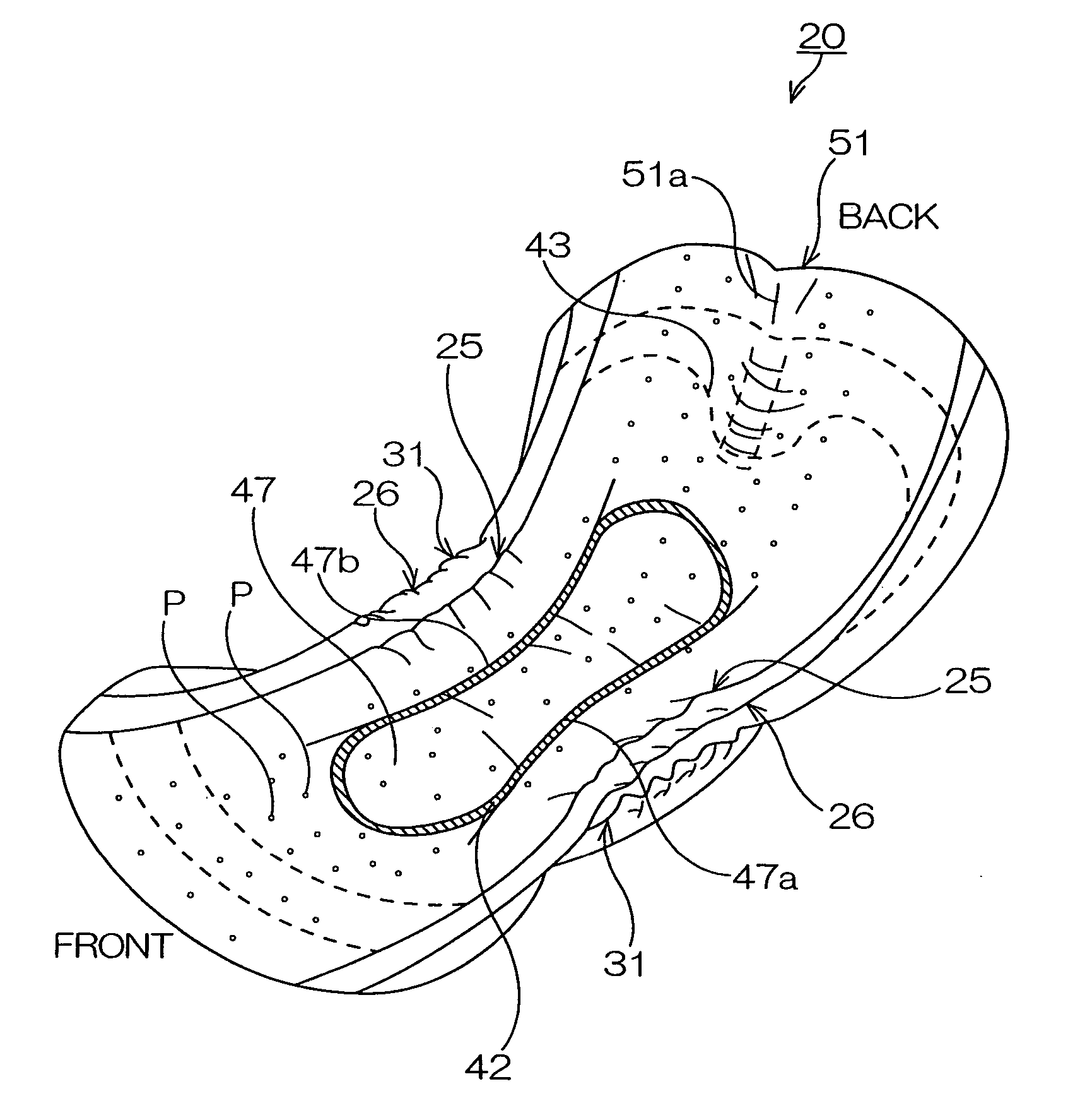 Absorbable product