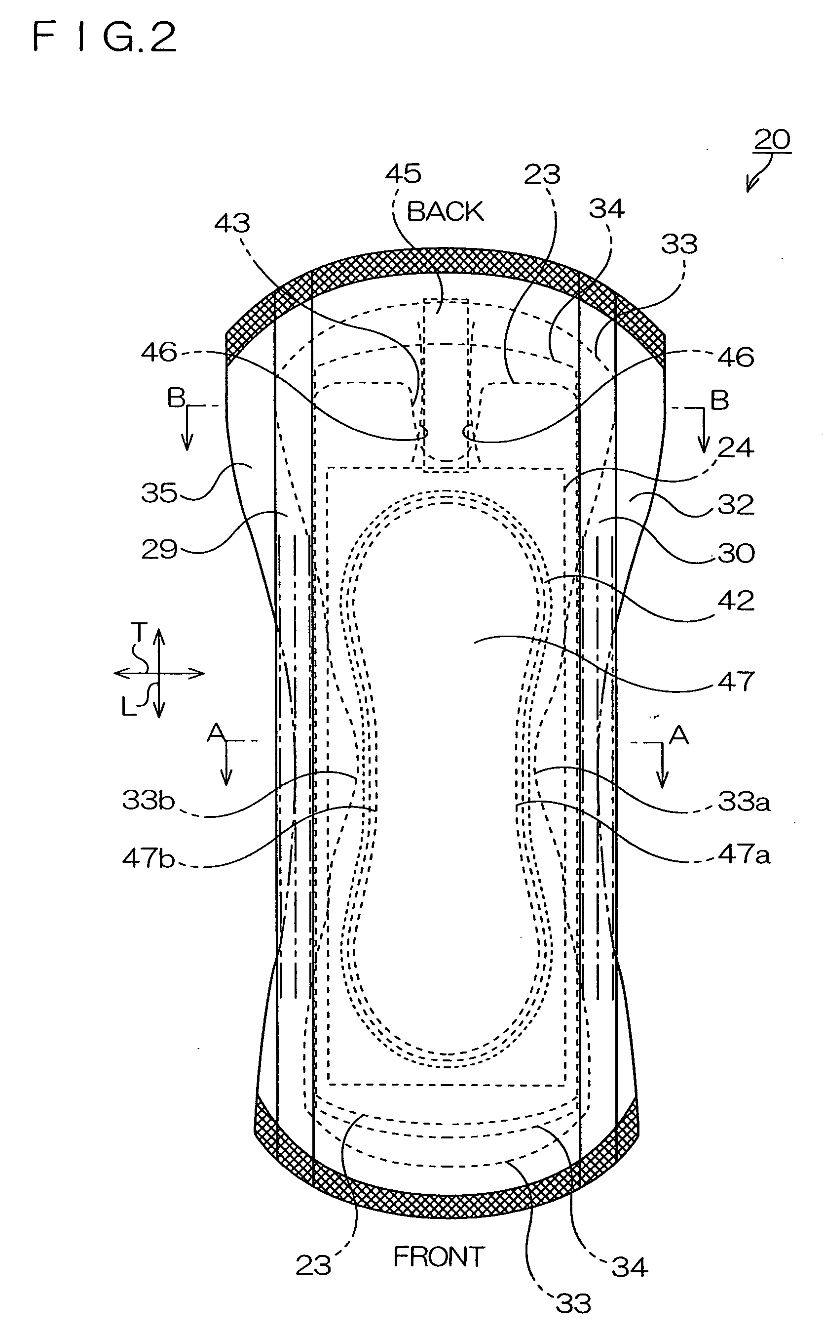 Absorbable product