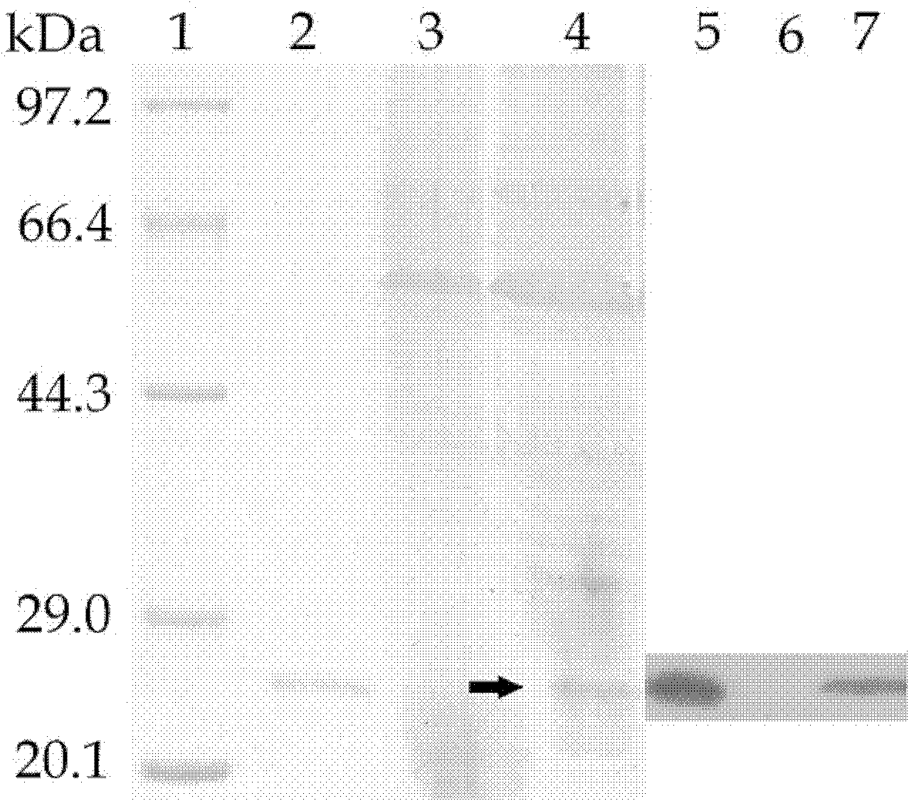 Recombination food-grade lactic acid bacterium capable of being used for preventing or treating human ulcerative colitis as well as preparation method and application of recombination food-grade lactic acid bacterium