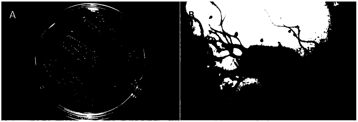 Radix curcumae endophytic bacteria strain ZJU-C612-2 and application thereof