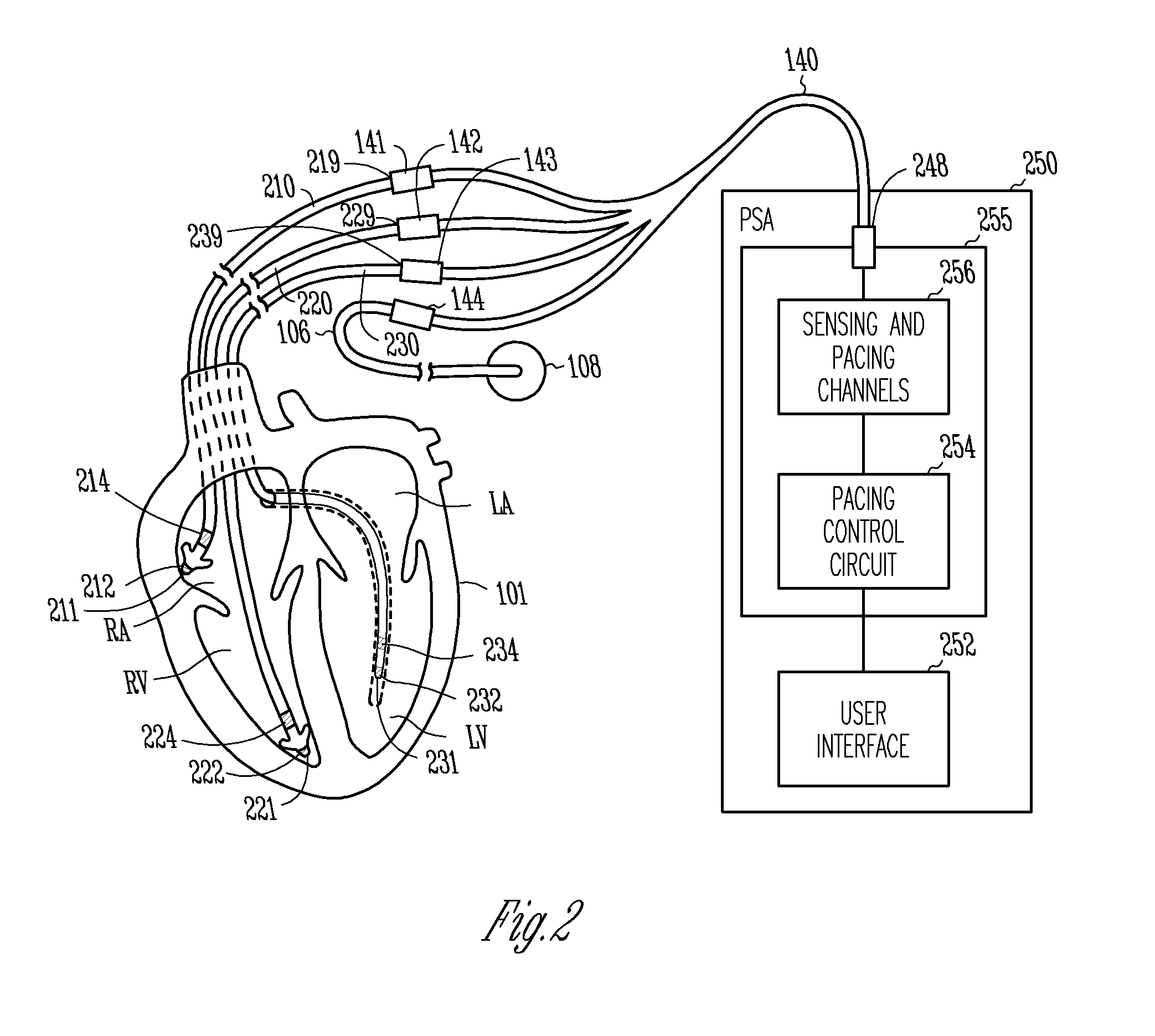 Pacing system analyzer having three sensing and pacing channels