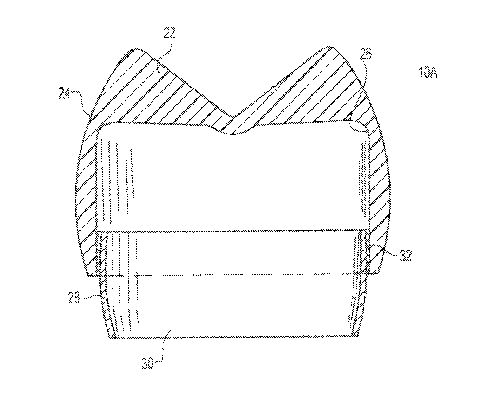 Pedodontic/veterinary dental crown system