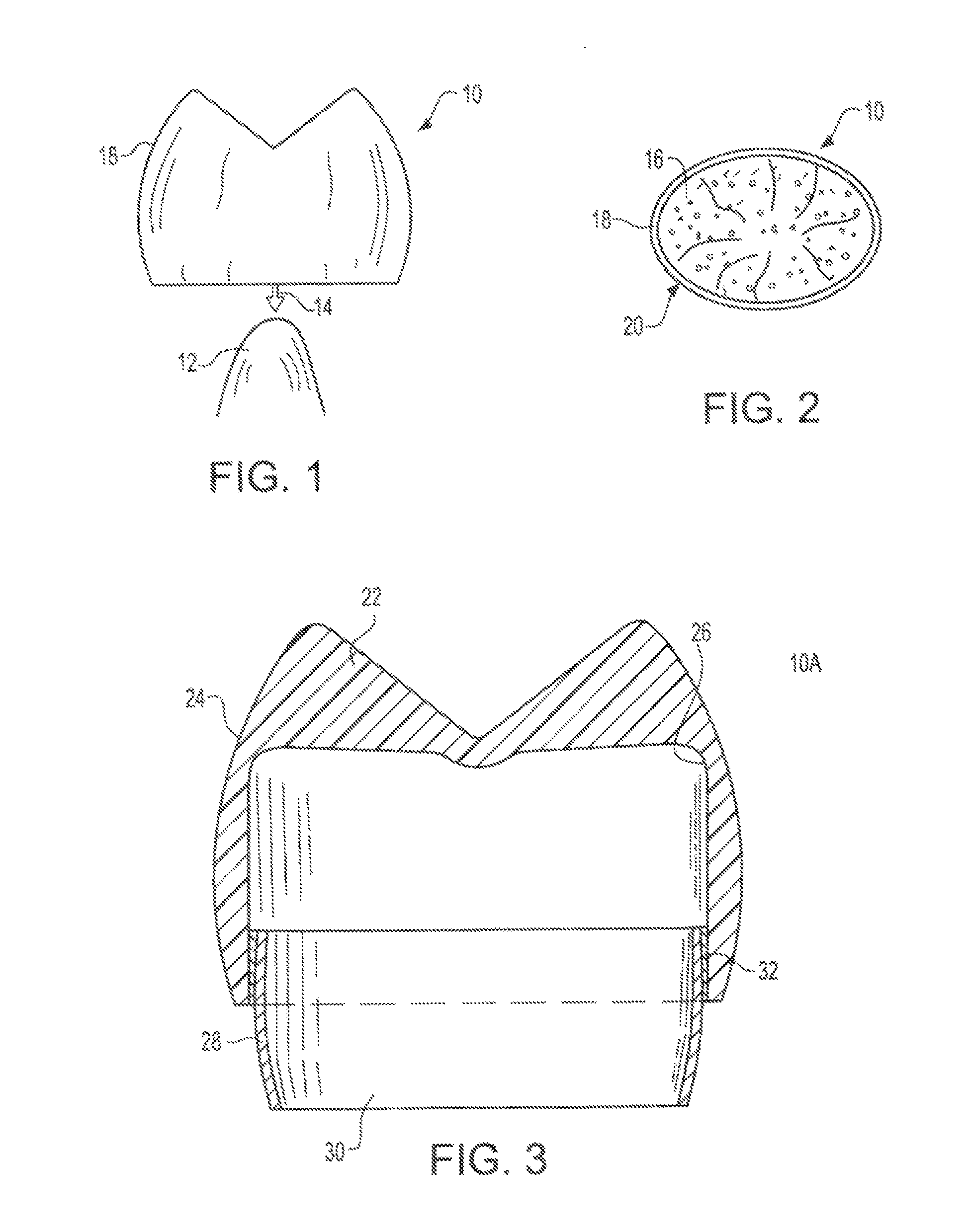 Pedodontic/veterinary dental crown system