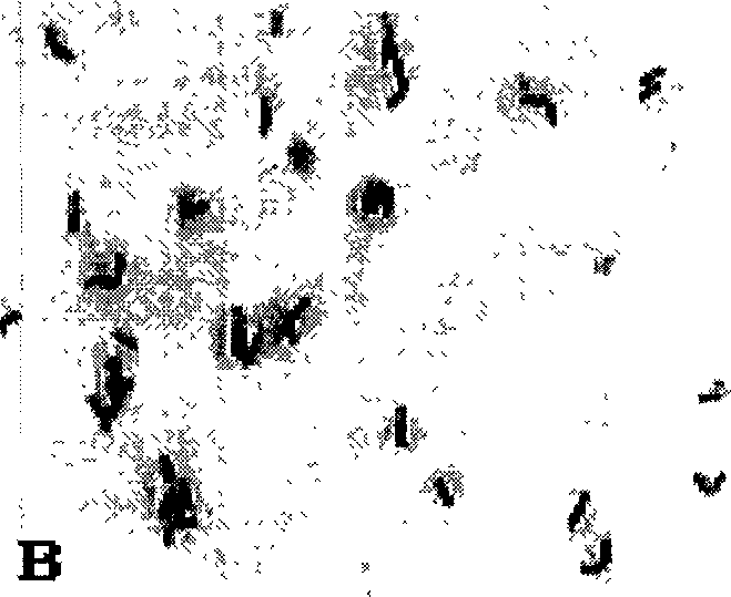 Nattokinase and its coding gene and clone and expressing method