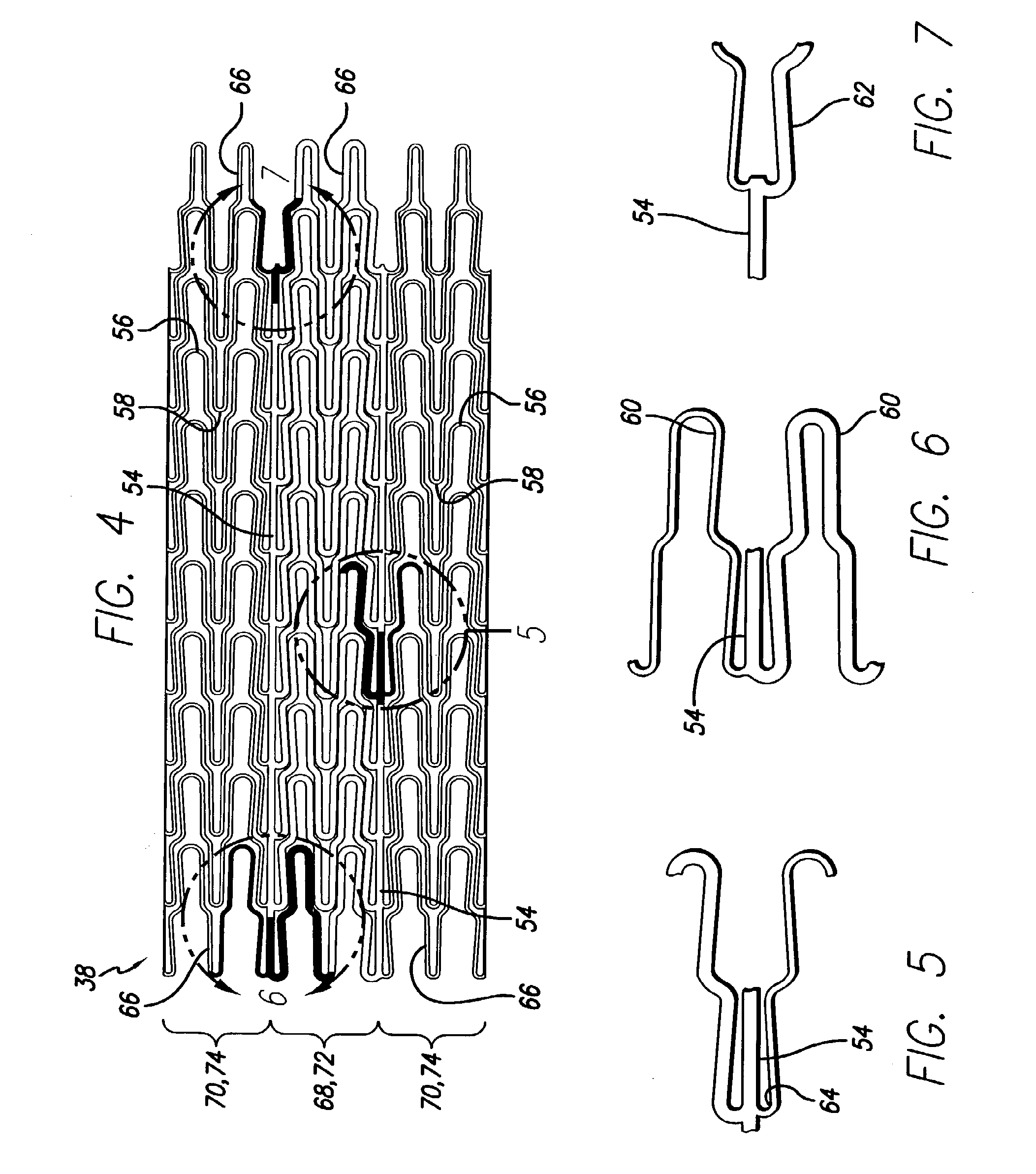 Intravascular stent for treating vulnerable plaque and method of use