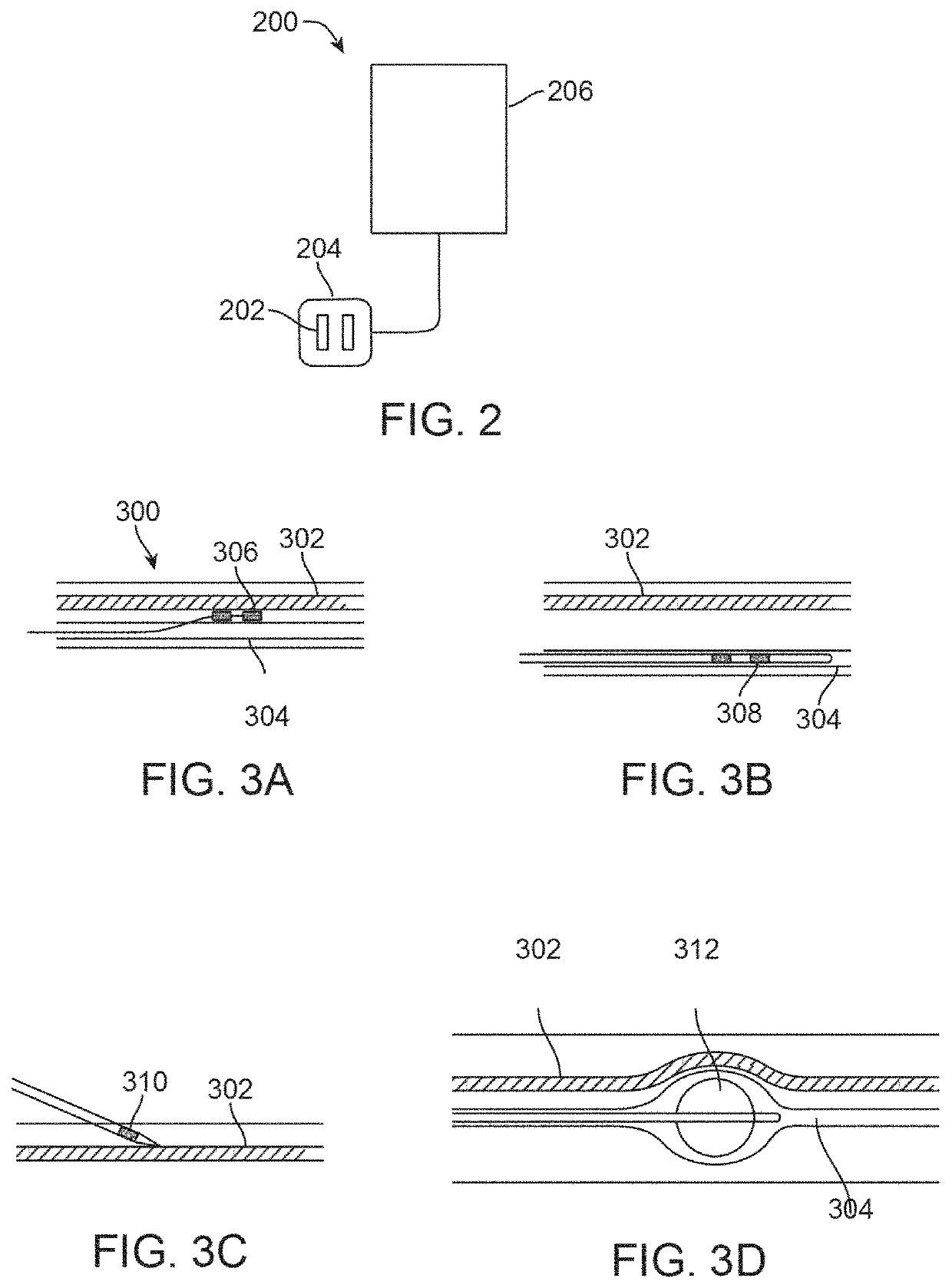 Vagus nerve stimulation pre-screening test