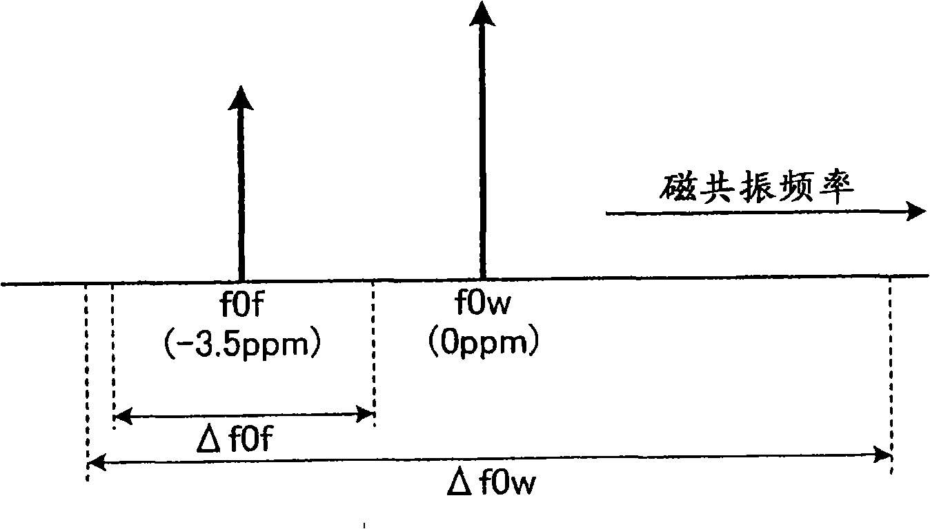 MRI apparatus