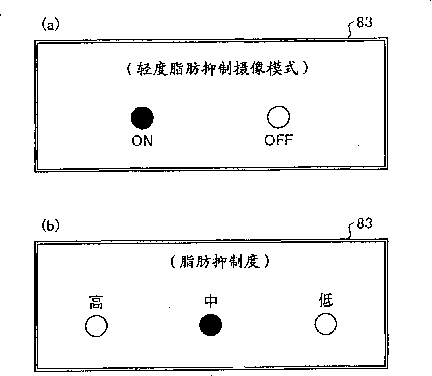 MRI apparatus