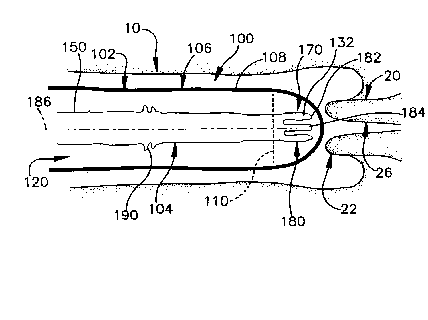 Timing of Ovulation Based on Vaginal Ph