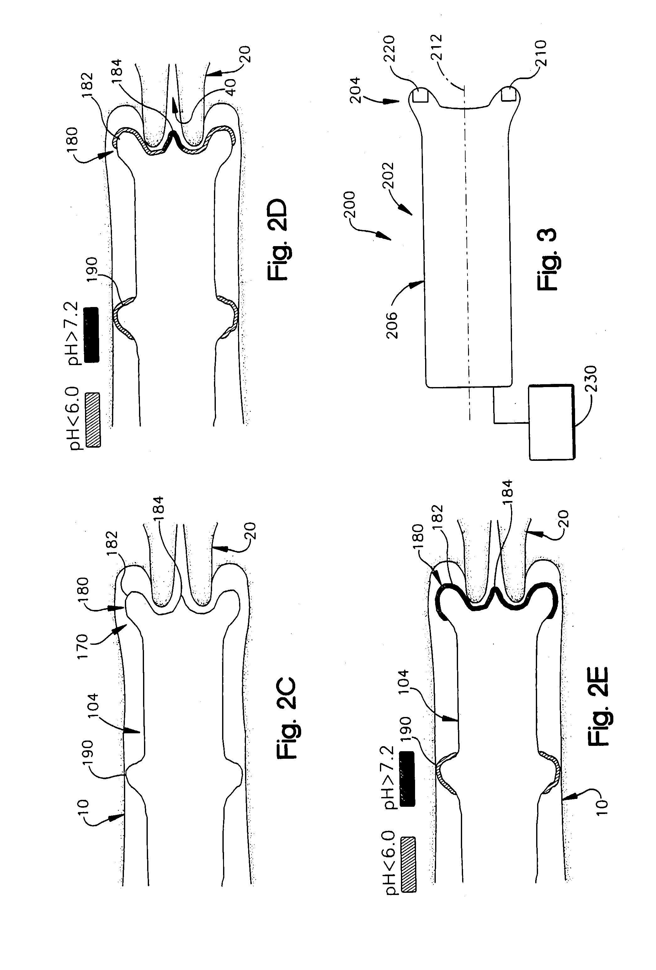 Timing of Ovulation Based on Vaginal Ph