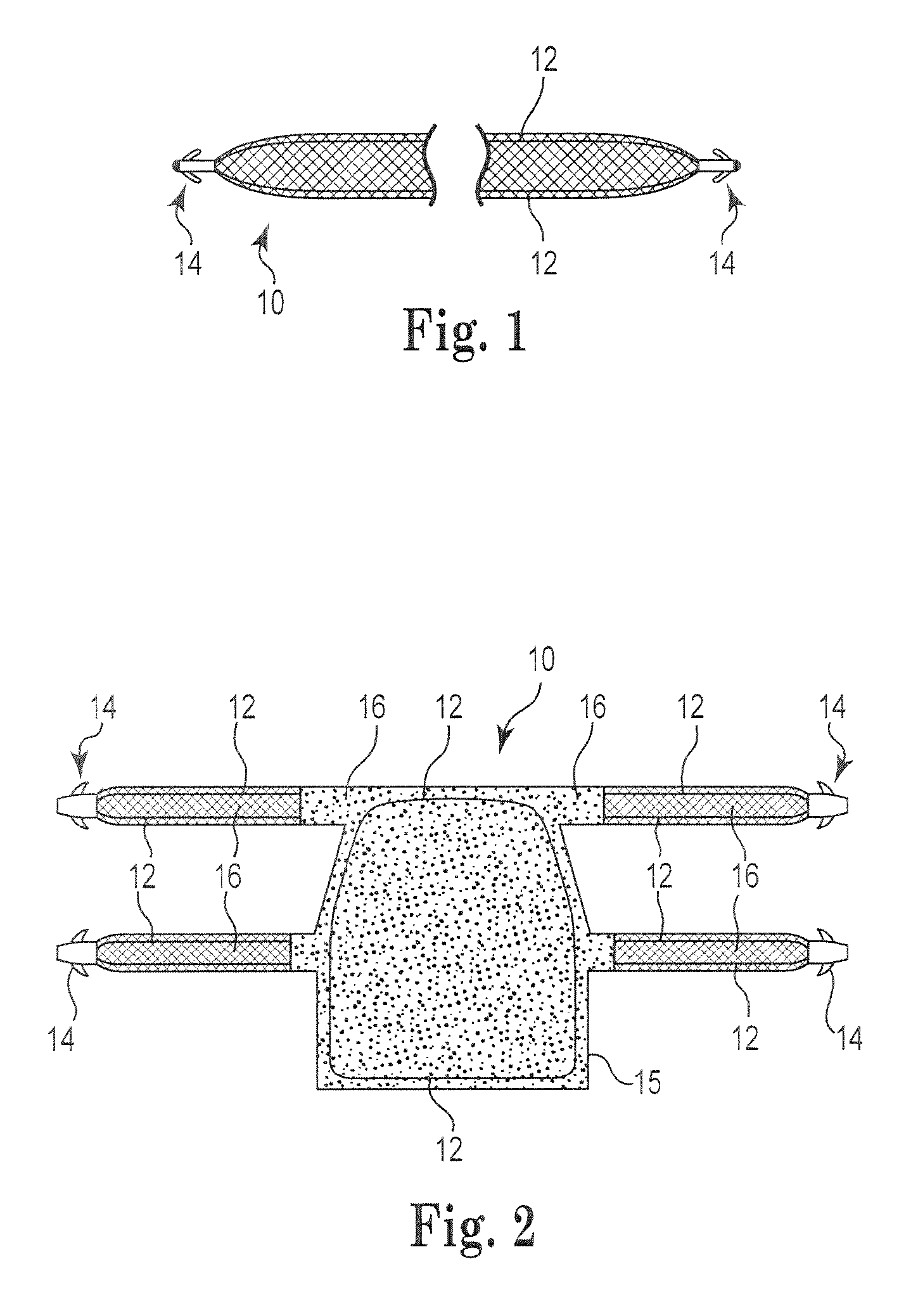 Pelvic Implants having Perimeter Imaging Features