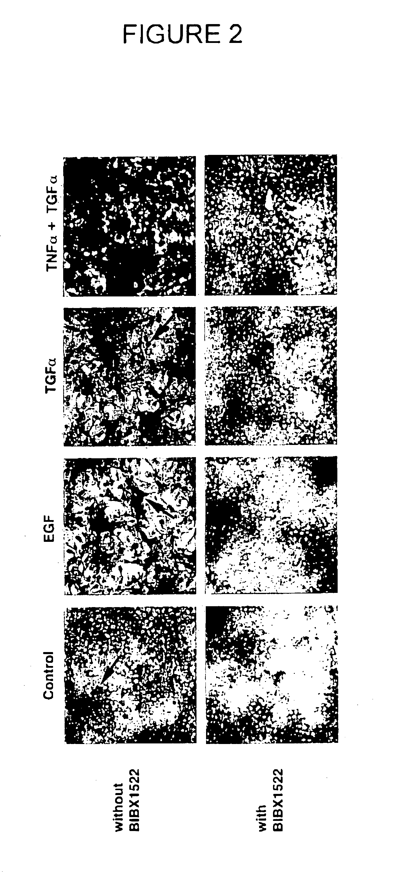 Preventing airway mucus production by administration of EGF-R antagonists