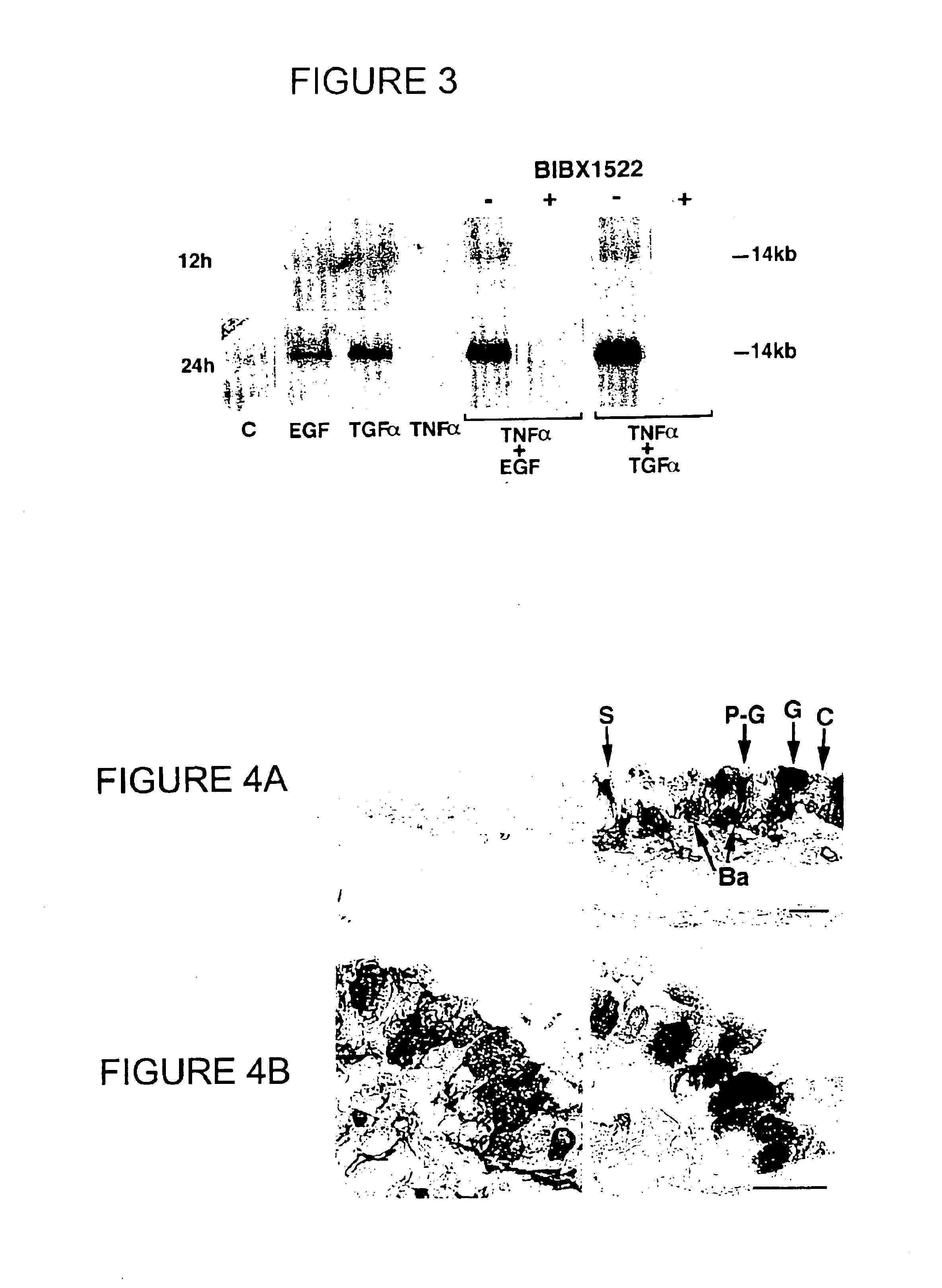 Preventing airway mucus production by administration of EGF-R antagonists