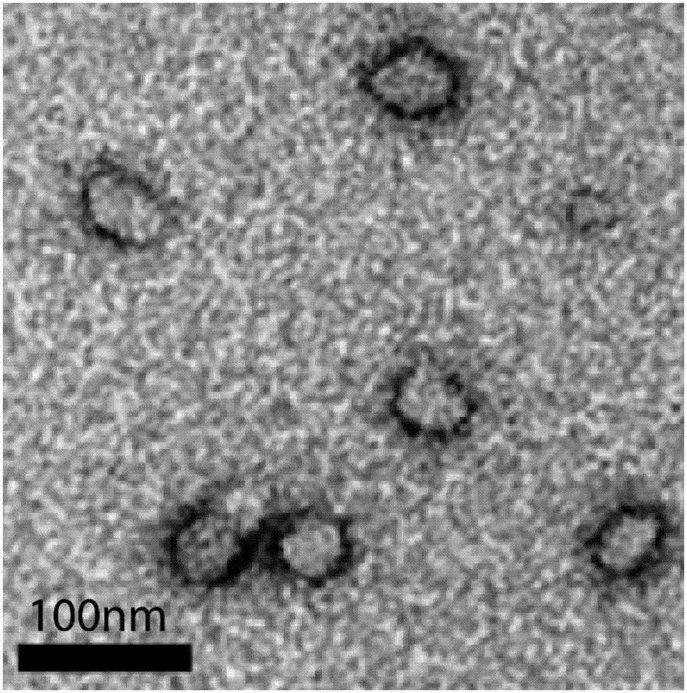 Docetaxel polymer nano-micelle injection, and preparation method and application thereof in preparation of tumor drugs