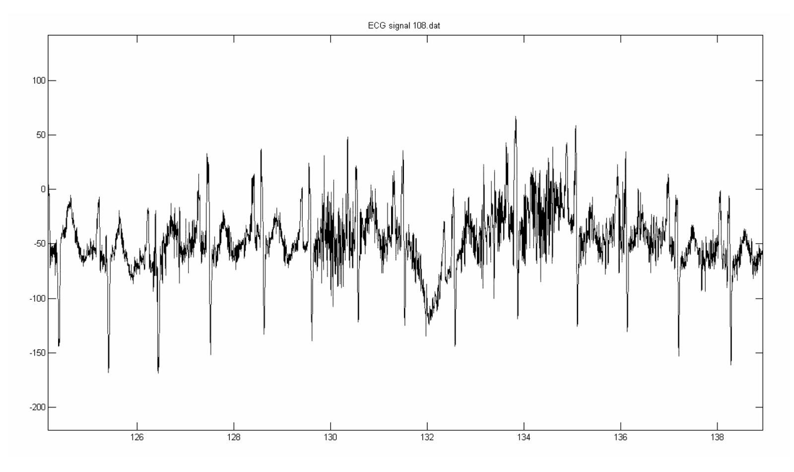 Electrocardiosignal noise analysis method