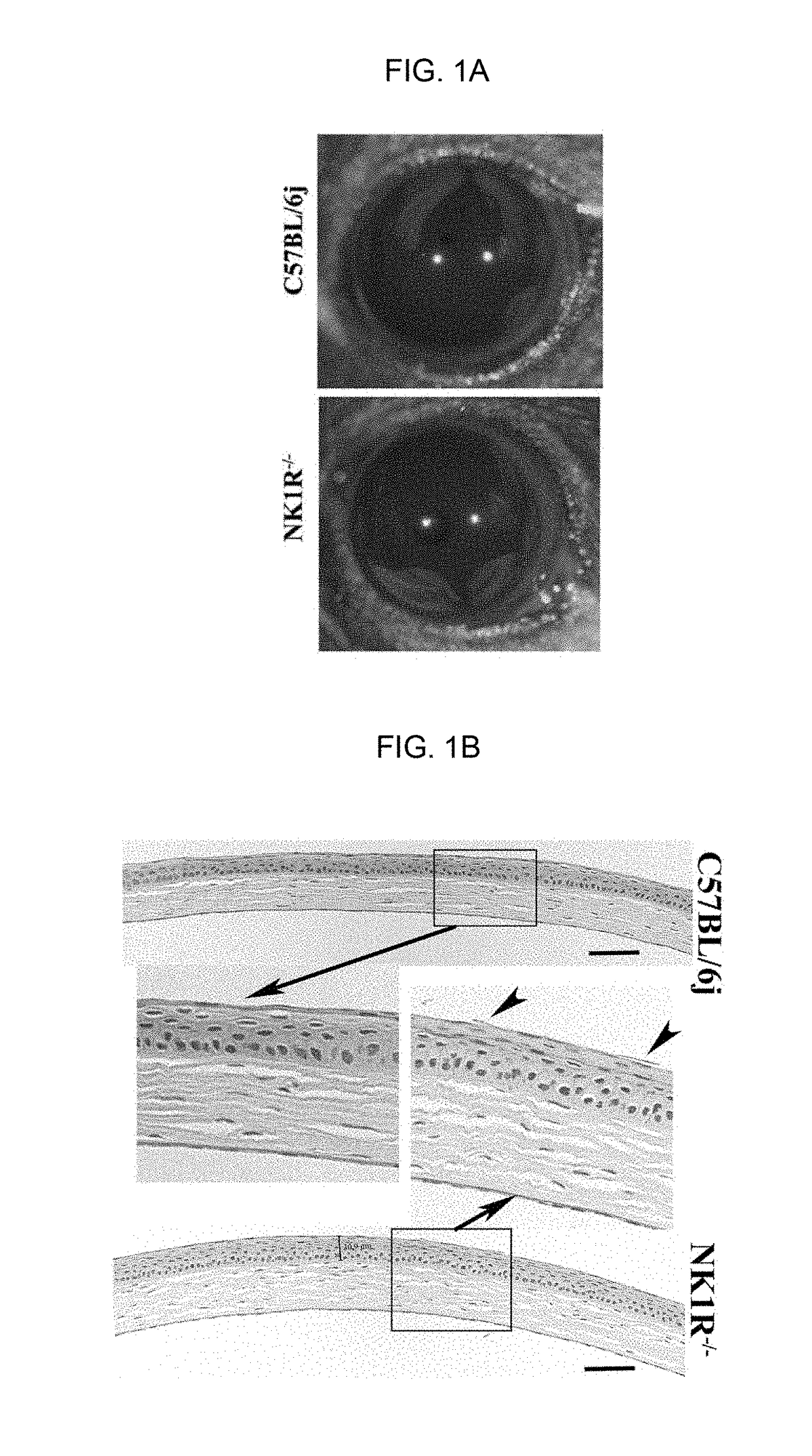 Neurokinin 1 receptor agonist mediated protection of the eye